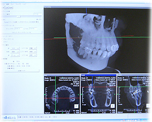 ₷炬Ȉ@̂bsiRgQBeujɂăV~[VsȂ܂B